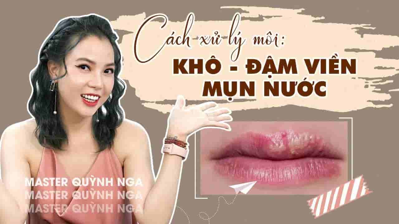 Môi Khô - Môi Đậm Viền - Môi Bị Mụn Nước, Nguyên Nhân Và Cách Xử Lý
